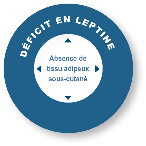 Déficit en leptine — Absence de tissu adipeux sous-cutané